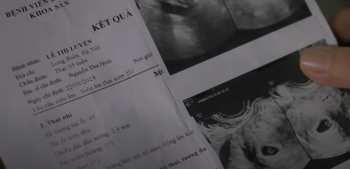 Lưu (NSƯT Hoàng Hải) bất ngờ khi thấy kết quả siêu âm. Ảnh: CMH. Lưu (NSƯT Hoàng Hải) bất ngờ khi thấy kết quả siêu âm. Ảnh: CMH.