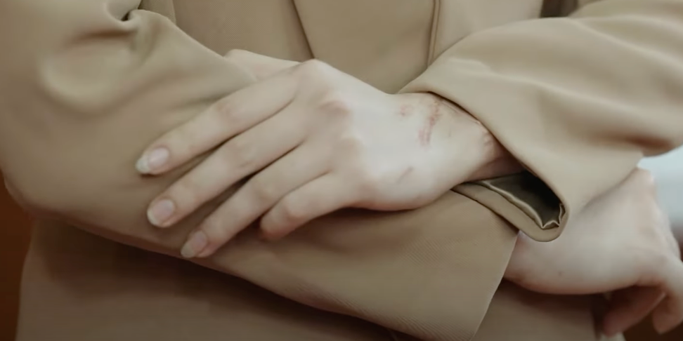 Gia An (Lãnh Thanh) phát hiện tay Phương (Việt Hoa) có nhiều vết sẹo. Ảnh: CMH. Gia An (Lãnh Thanh) phát hiện tay Phương (Việt Hoa) có nhiều vết sẹo. Ảnh: CMH.