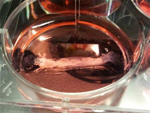 Một mẫu thịt nhân tạo từ tế bào gốc trong phòng thí nghiệm. Ảnh:PA