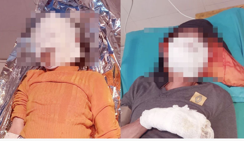 Hai vợ chồng ở Tuyên Quang bị bỏng nặng do điện thoại phát nổ. Ảnh: BVCC