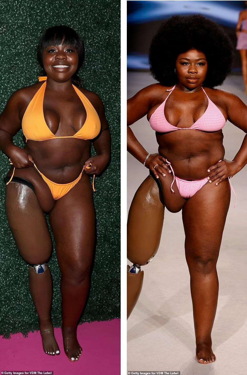 Ngôi sao 31 tuổi truyền cảm hứng lớn cho những người có khiếm khuyết cơ thể. Không chỉ là người mẫu, Marsha còn thành công với vai trò ca/nhạc sĩ.