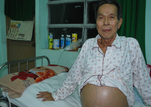 Những sao Việt giành giật sự sống với bệnh hiểm nghèo ảnh 2