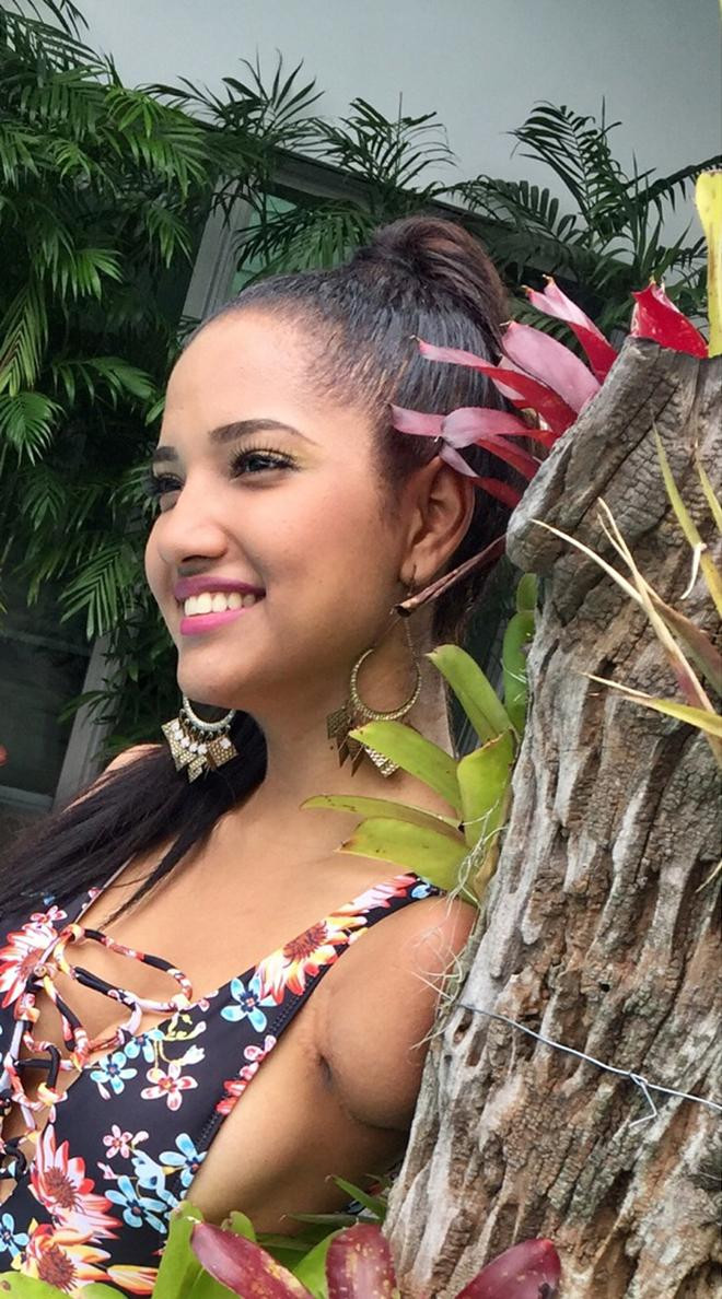 Tham gia Miss Ecuador năm nay, cô gái 25 tuổi muốn truyền thông điệp về sự mạnh mẽ và hy vọng xã hội đồng cảm hơn với những người khuyết tật như cô.