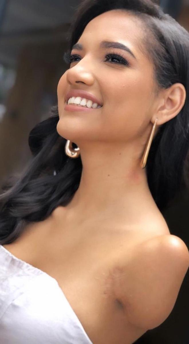 Các diễn đàn sắc đẹp đều rất ủng hộ Victoria khi cô tham gia sân chơi nhan sắc cấp quốc gia. Trang instagram của người đẹp đang nhận được sự yêu mến rất lớn từ các fans sắc đẹp trên thế giới.