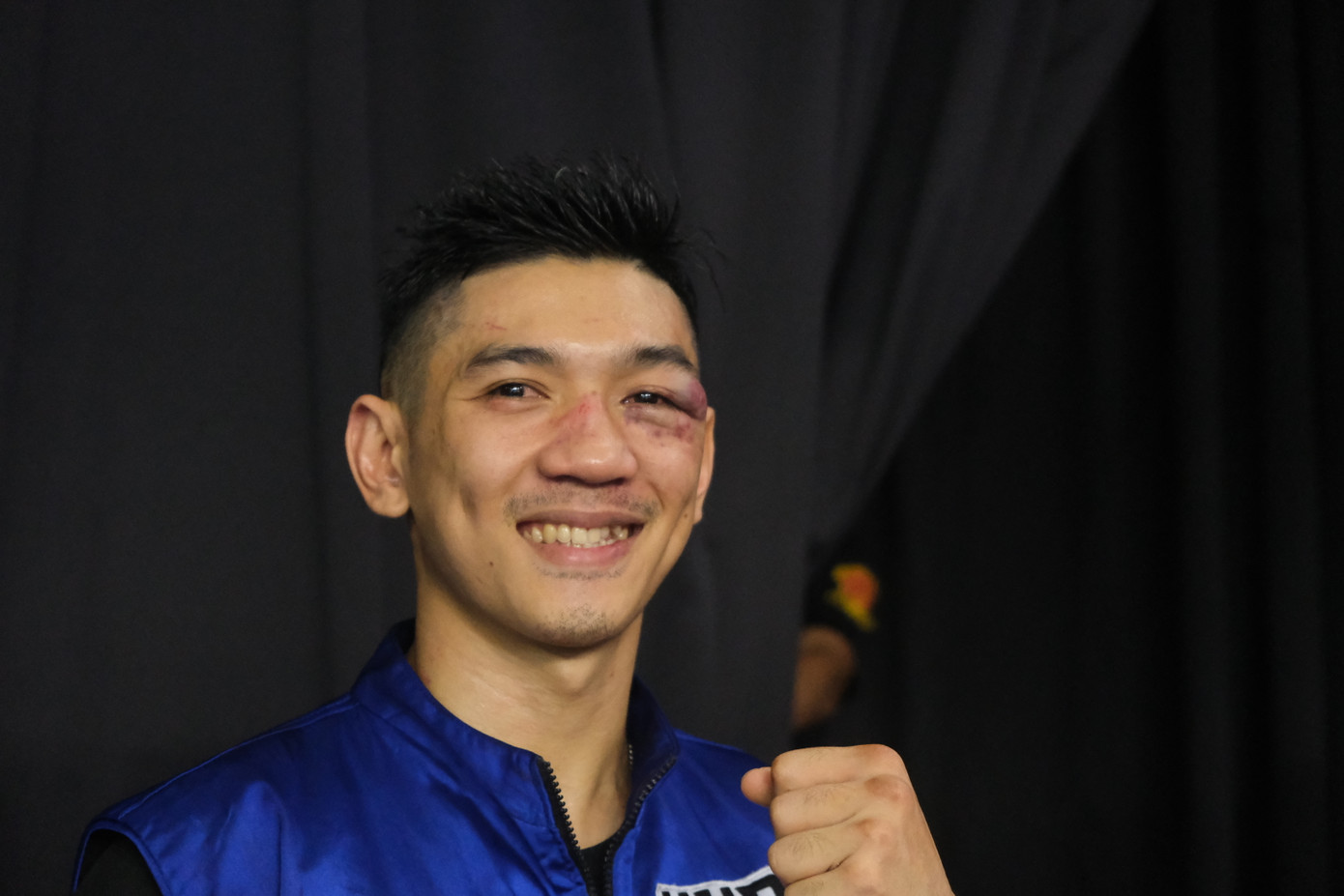 Gương mặt gần như biến dạng của Huỳnh Hoàng Phi sau trận đấu. Gương mặt gần như biến dạng của Huỳnh Hoàng Phi sau trận đấu.