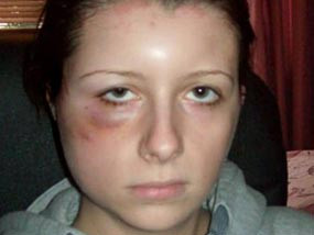 Rachel Dowley sau khi nhuộm tóc.