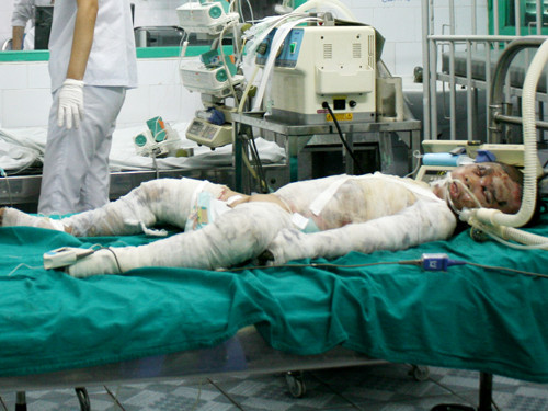 Bé Trần Thị Ngọc phải thở bằng ô-xy