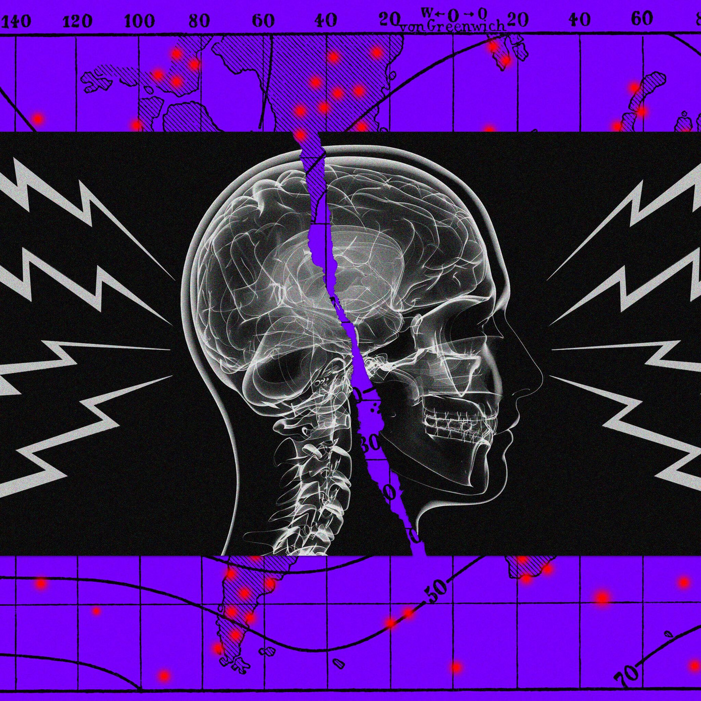 Hội chứng Havana gây chóng mặt, đau đầu, buồn nôn... Minh họa: New York Times.