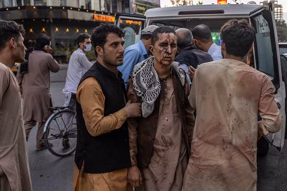 Một người đàn ông bị thương đến bệnh viện ở Kabul sau vụ nổ. Ảnh: The New York Times.