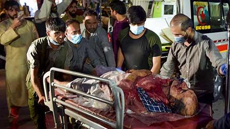 Tình nguyện viên và nhân viên y tế giúp đỡ một người đàn ông bị thương. Ảnh: Getty Images.