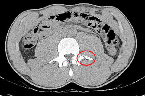 Neymar đại nạn không chết, có quý nhân phù trợ ảnh 1