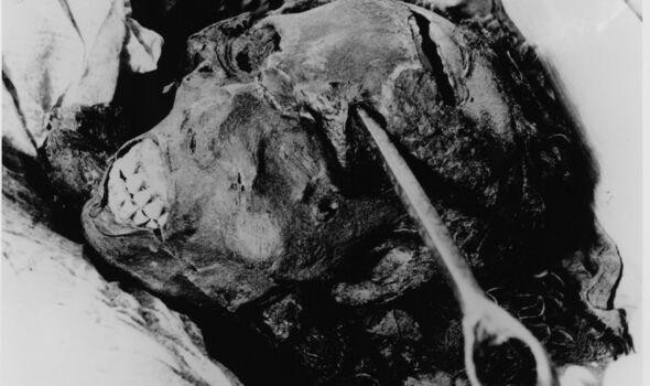 Những vết thương kinh hoàng trên mặt và trán. Ảnh Express. Những vết thương kinh hoàng trên mặt và trán. Ảnh Express.