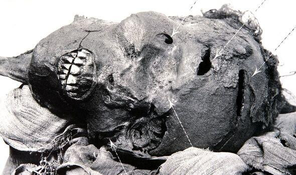 Gương mặt méo méo, vặn vẹo của vị pharaoh Ai Cập cổ đại. Ảnh Express. Gương mặt méo méo, vặn vẹo của vị pharaoh Ai Cập cổ đại. Ảnh Express.