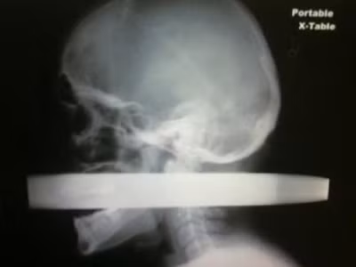 Phim chụp của Andrew Driver Linn. Phim chụp