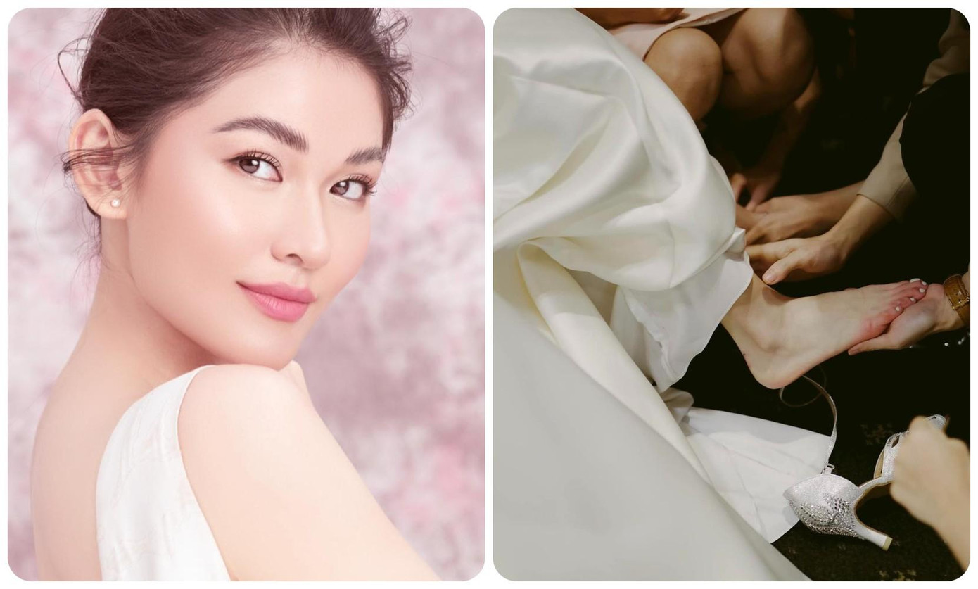 Á hậu Thùy Dung bị bỏng nặng trong đám cưới. Ảnh: NVCC. Á hậu Thùy Dung bị bỏng nặng trong đám cưới. Ảnh: NVCC.