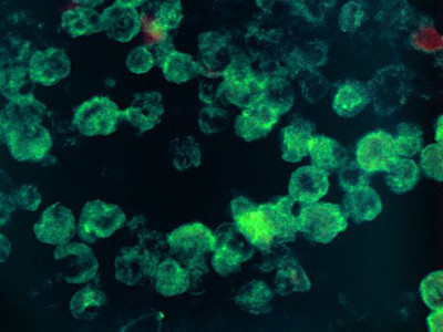 Amip ăn não có tên Naegleria fowleri thường cư trú trong sông, suối