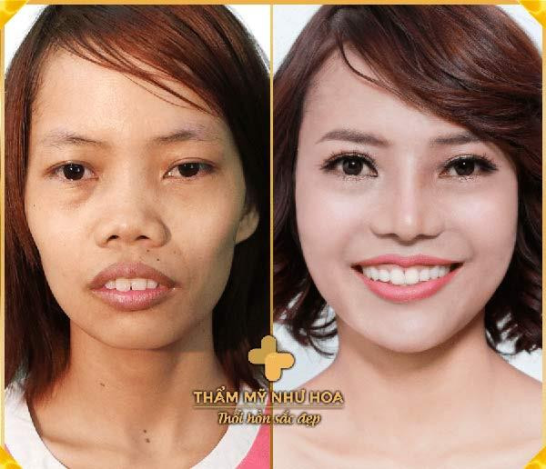 Ths.Bác sĩ Tống Hải và nỗ lực giúp đỡ những cảnh đời 'khổ vì xấu' ảnh 3