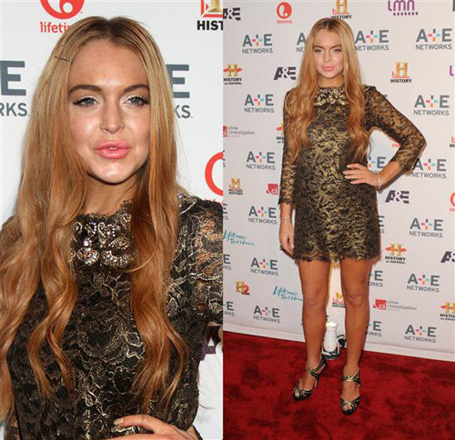 Một minh chứng hoàn hảo cho sự tàn phá của công nghệ thẩm mỹ đối với những ngôi sao 