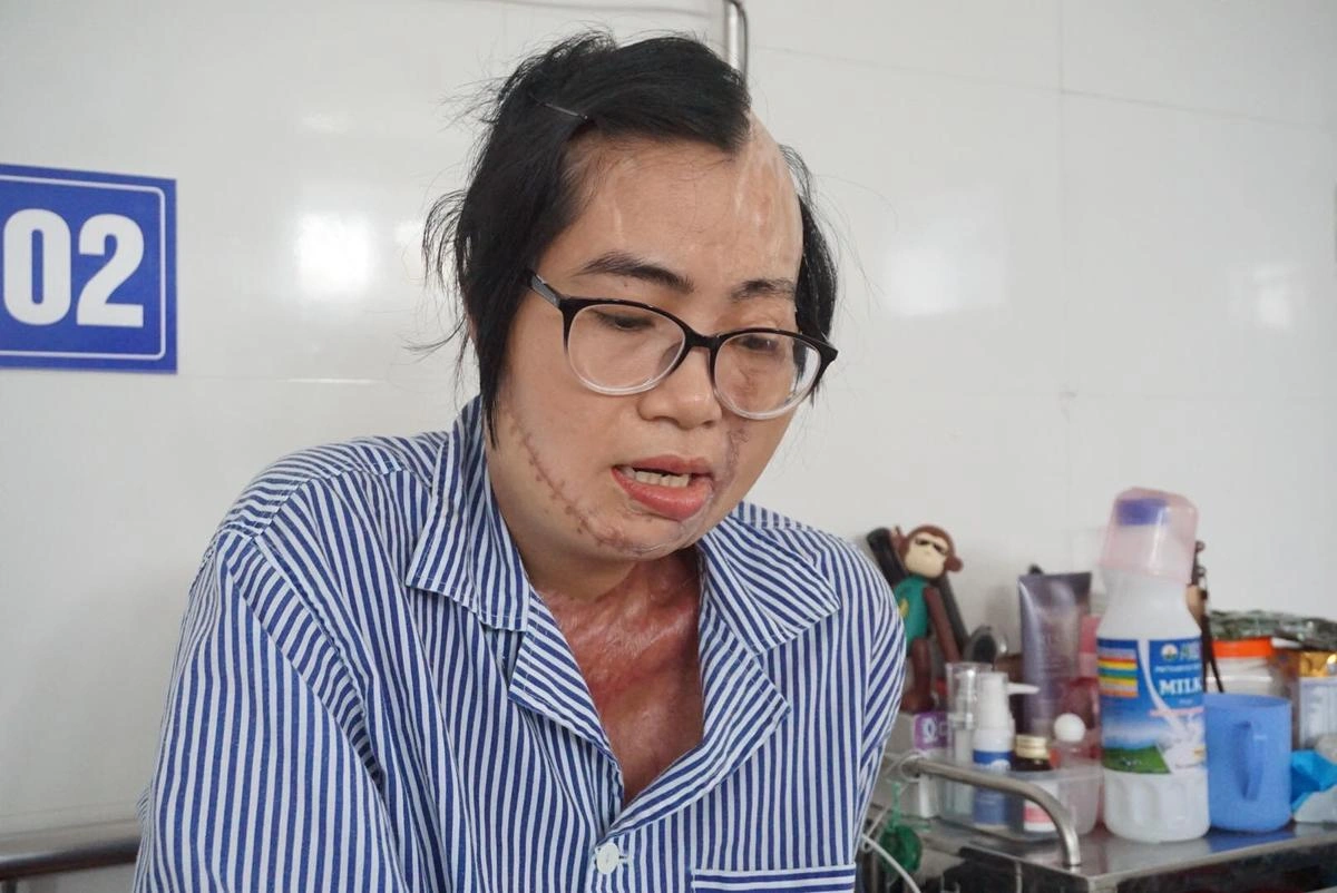 Chị Huyền trong những ngày cấp cứu. Ảnh: Định Nguyễn. Chị Huyền trong những ngày cấp cứu. Ảnh: Định Nguyễn.