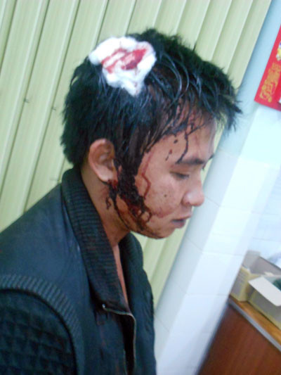 Thắng bị đánh chảy máu đầu