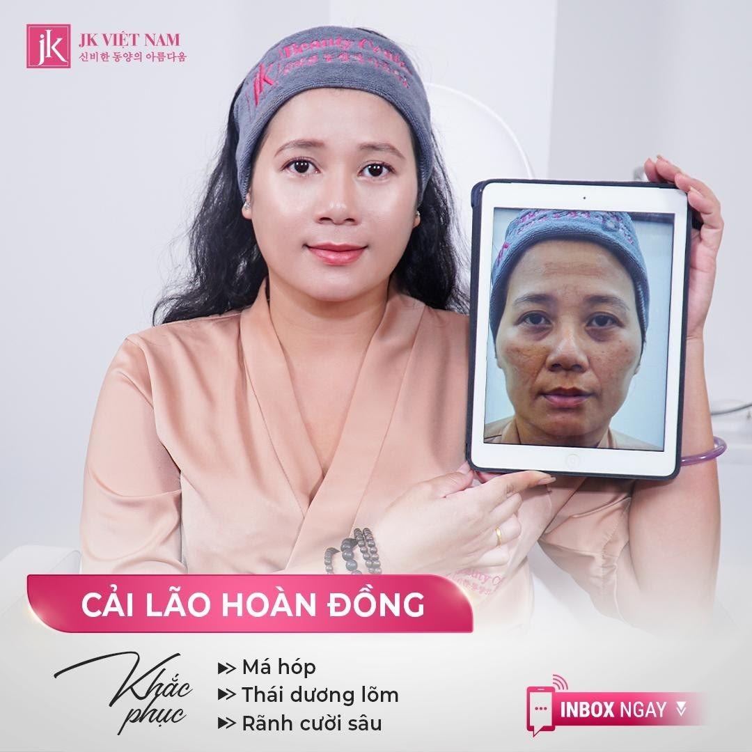 Gương mặt đầy đặn phúc hậu với 60 phút cải lão hoàn đồng tại JK