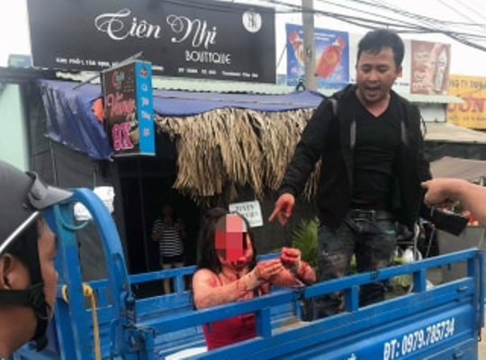 Nữ nhân viên quán cà phê chòi nghi bị khách đánh dã man ảnh 2