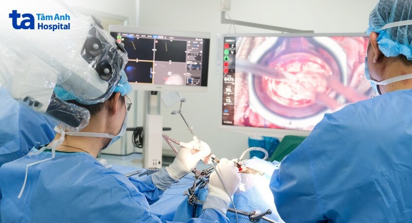 Rô-bốt mổ não thế hệ mới ứng dụng trí tuệ nhân tạo phát huy hiệu quả tối ưu trong phẫu thuật (ảnh: BVCC)