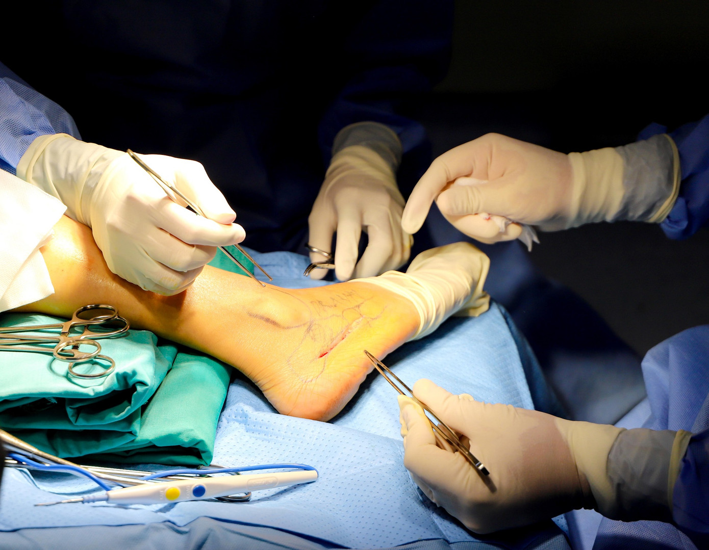 Nữ bệnh nhân được bác sĩ chẩn đoán bị bệnh nhuyễn xương rất hiếm gặp