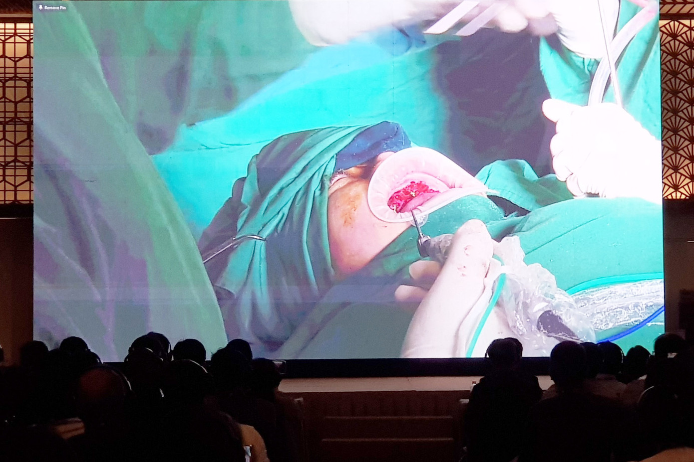 Một cuộc phẫu thuật điều trị cho bệnh nhân mất răng hoàn toàn được tường thuật trực tiếp tại hội nghị