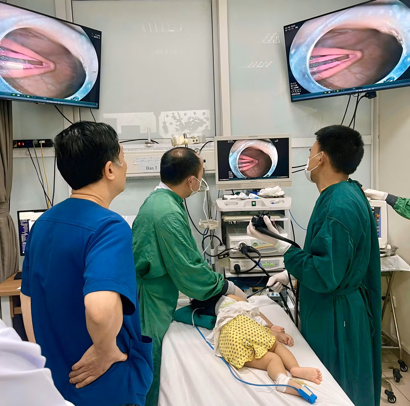 Các bác sĩ nội soi gắp dị vật Các bác sĩ nội soi gắp dị vật