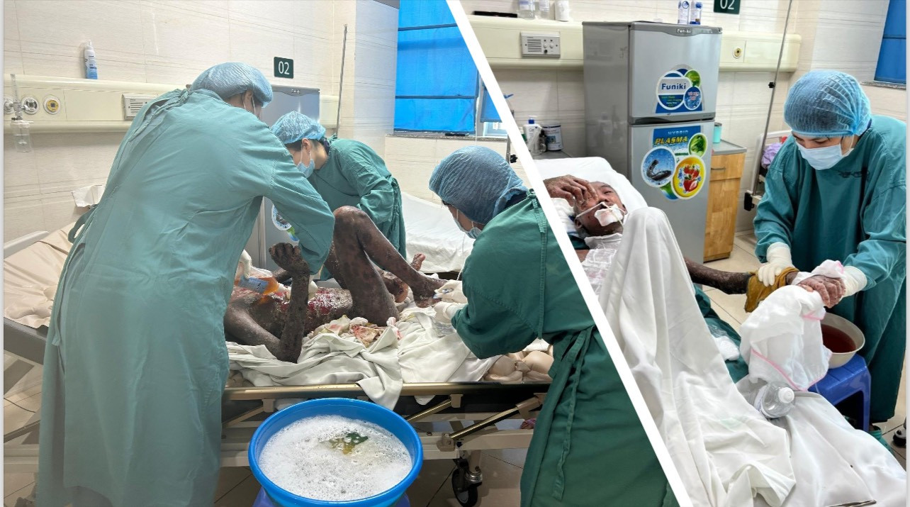 Các điều dưỡng thay băng, chăm sóc da cho bệnh nhân Các điều dưỡng thay băng, chăm sóc da cho bệnh nhân