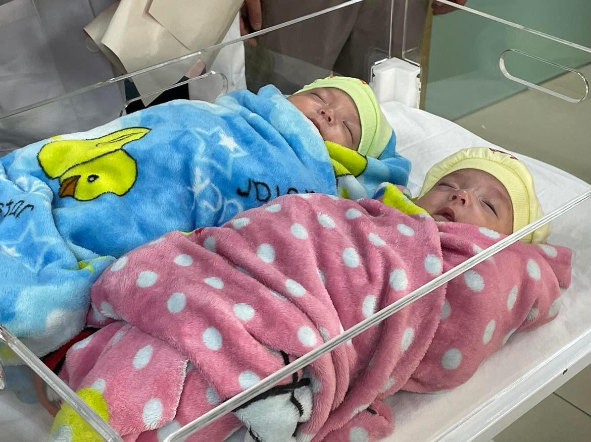 Cặp song sinh phát triển rất tốt Ảnh: Hà Minh