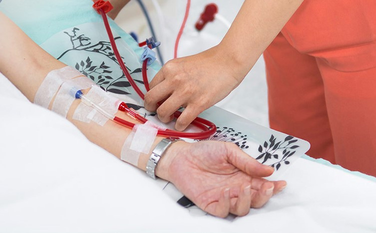 Tại Việt Nam nhiều bệnh nhân phải chạy thận nhân tạo do đái tháo đường. Tại Việt Nam nhiều bệnh nhân phải chạy thận nhân tạo do đái tháo đường.