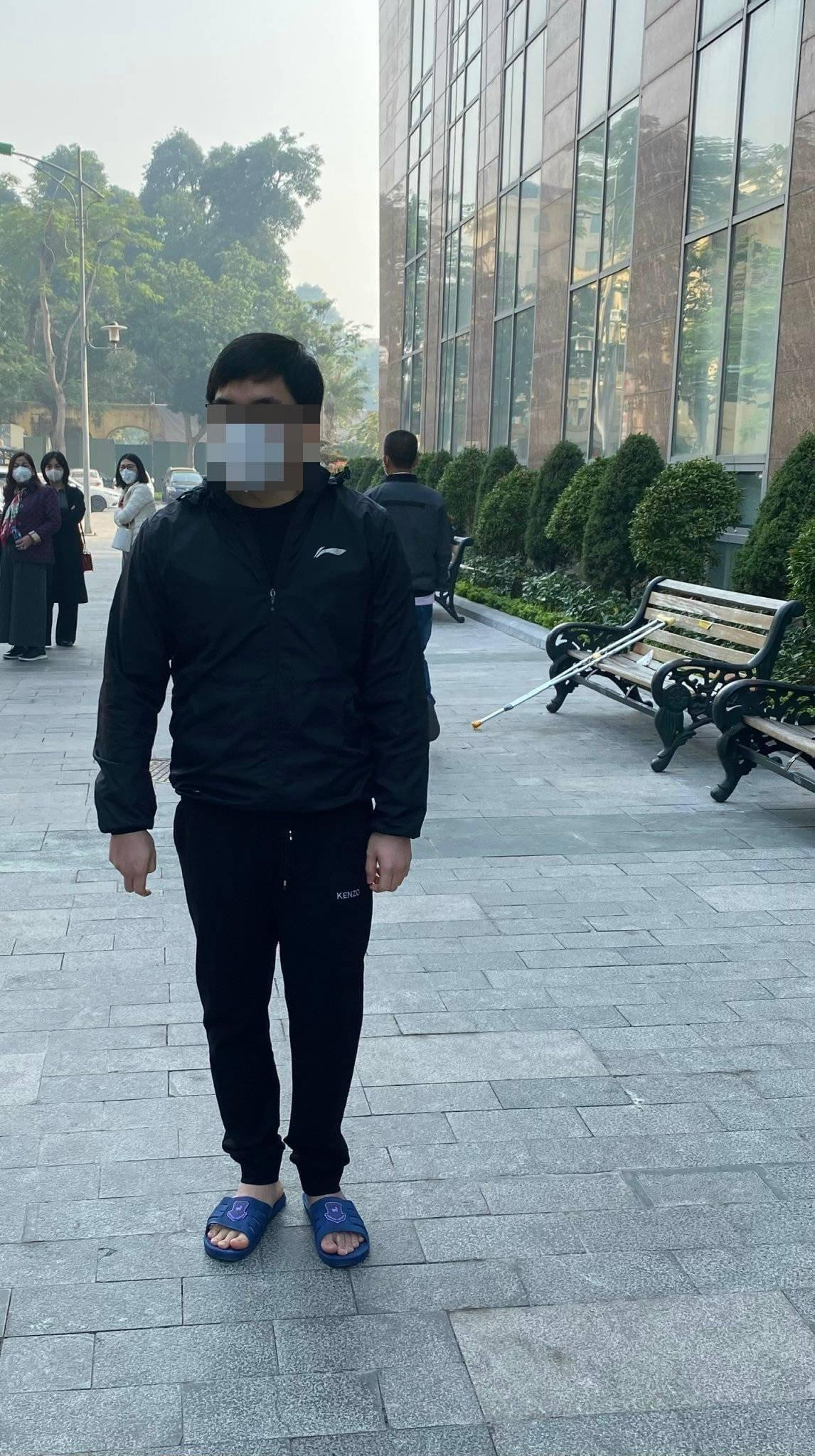 Bệnh nhân sau khi đã được kéo dài chân thêm 18cm