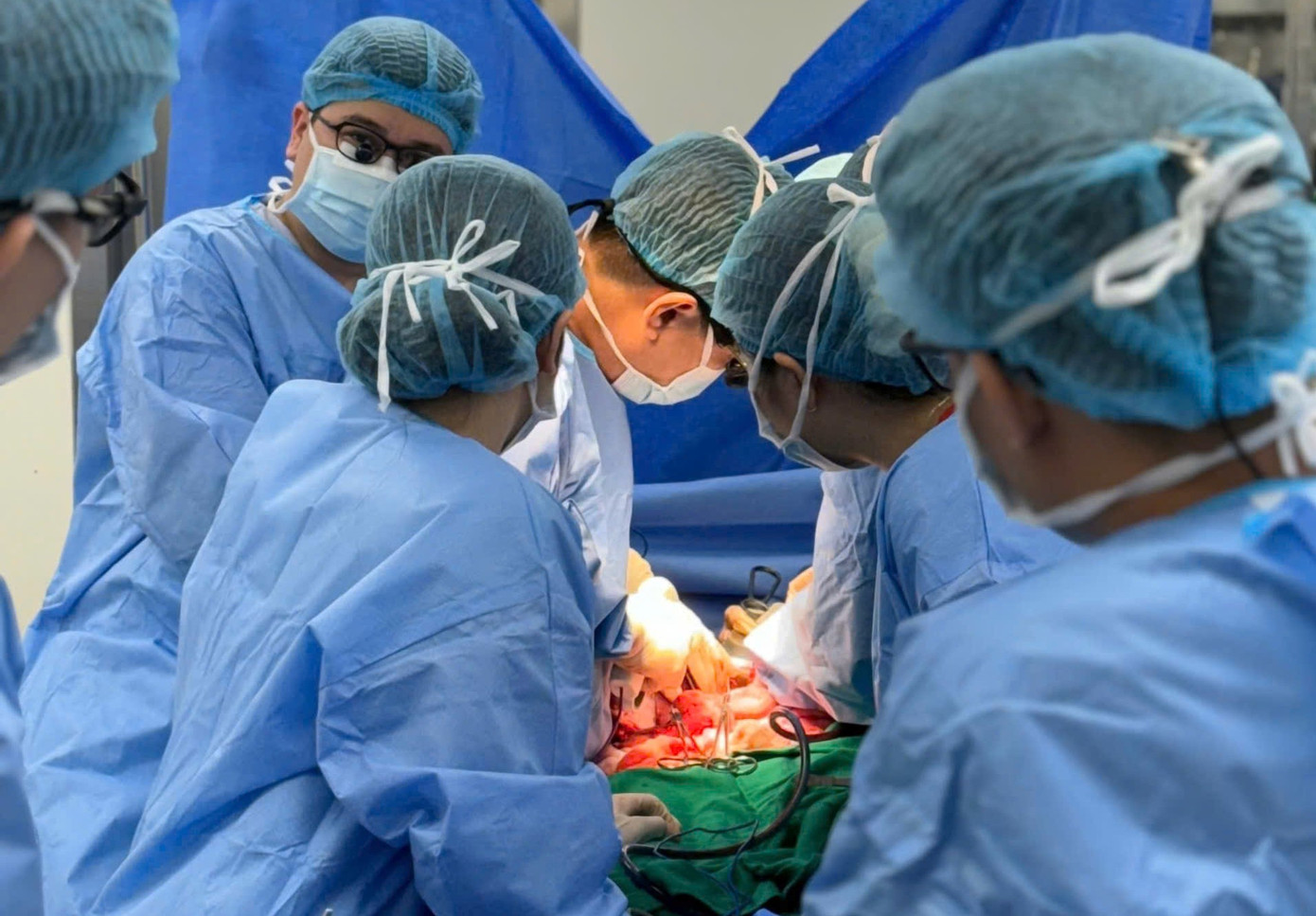 Các bác sĩ lấy gan từ người hiến chết não.