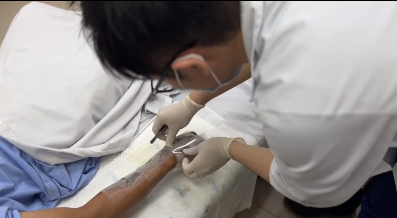 Bác sĩ chăm sóc vết thương cho bệnh nhân. Bác sĩ chăm sóc vết thương cho bệnh nhân.