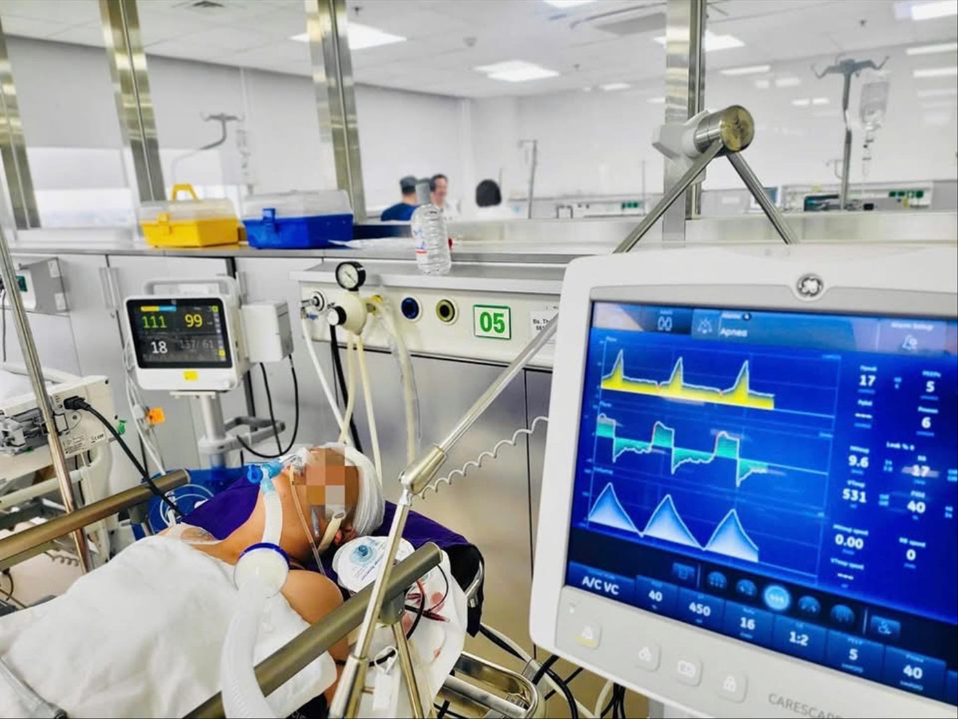 Bệnh nhân đột quỵ do dùng thuốc tránh thai kéo dài.