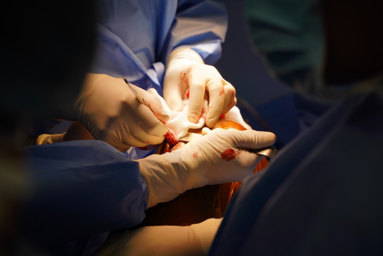 Từng thao tác cẩn trọng của các bác sĩ trong ca mổ