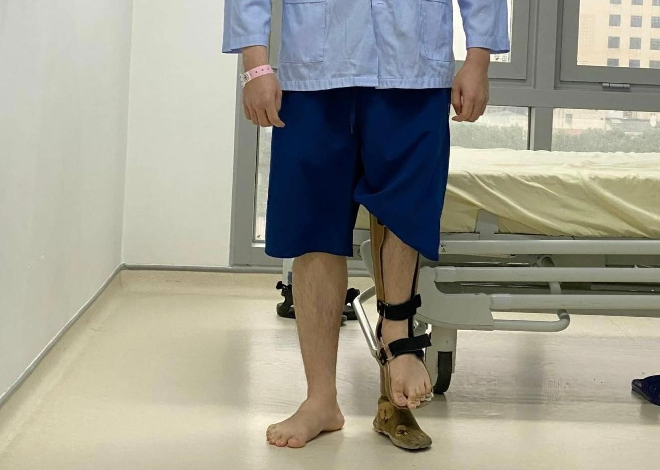 Bệnh nhân trước khi phẫu thuật kéo dài chân.