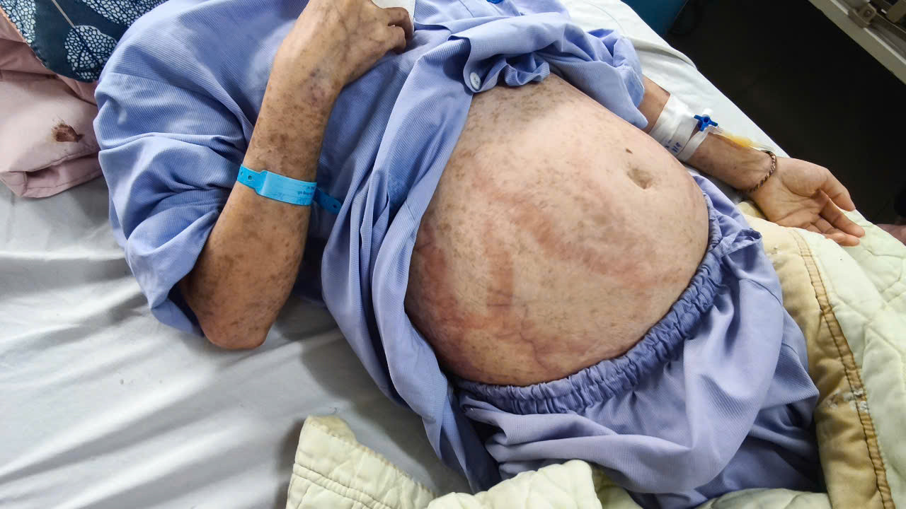 Cô gái trẻ bị dị ứng nặng do tự uống thuốc cảm Cô gái trẻ bị dị ứng nặng do tự uống thuốc cảm