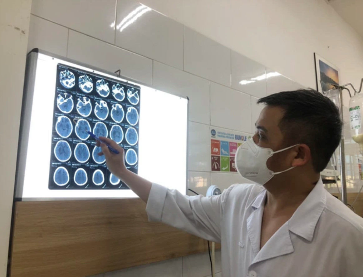 TS.BS Nguyễn Trung Nguyên đánh giá mức độ tổn thương não của bệnh nhân ngộ độc methanol