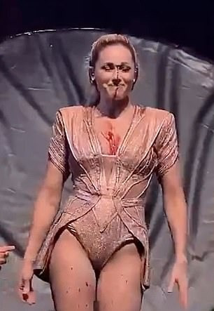 Helene Fischer bị rạch mặt, chảy máu đầm đìa trong lúc nhào lộn. Ảnh cắt từ video. Helene Fischer bị rạch mặt, chảy máu đầm đìa trong lúc nhào lộn. Ảnh cắt từ video.