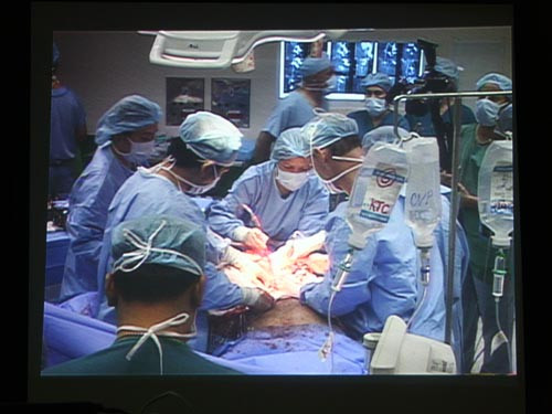 Ca mổ cho anh Hải đang thực hiện và truyền ra màn hình 