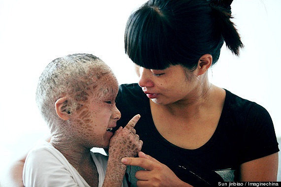 Bé Pan Xianhang, 8 tuổi, ngụ tại tỉnh Ôn Lĩnh, miền Đông Trung Quốc, không thể nào ngủ được mỗi khi đêm về