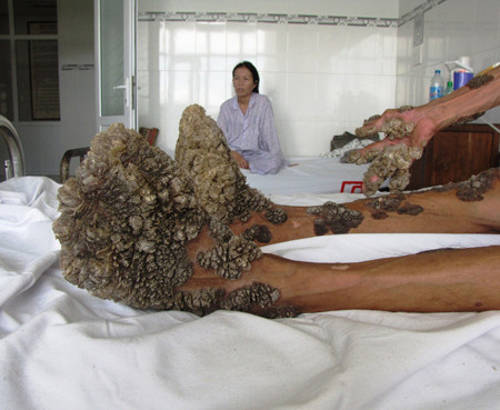 Bàn chân nhìn giống hệt một nhánh san hô màu đen