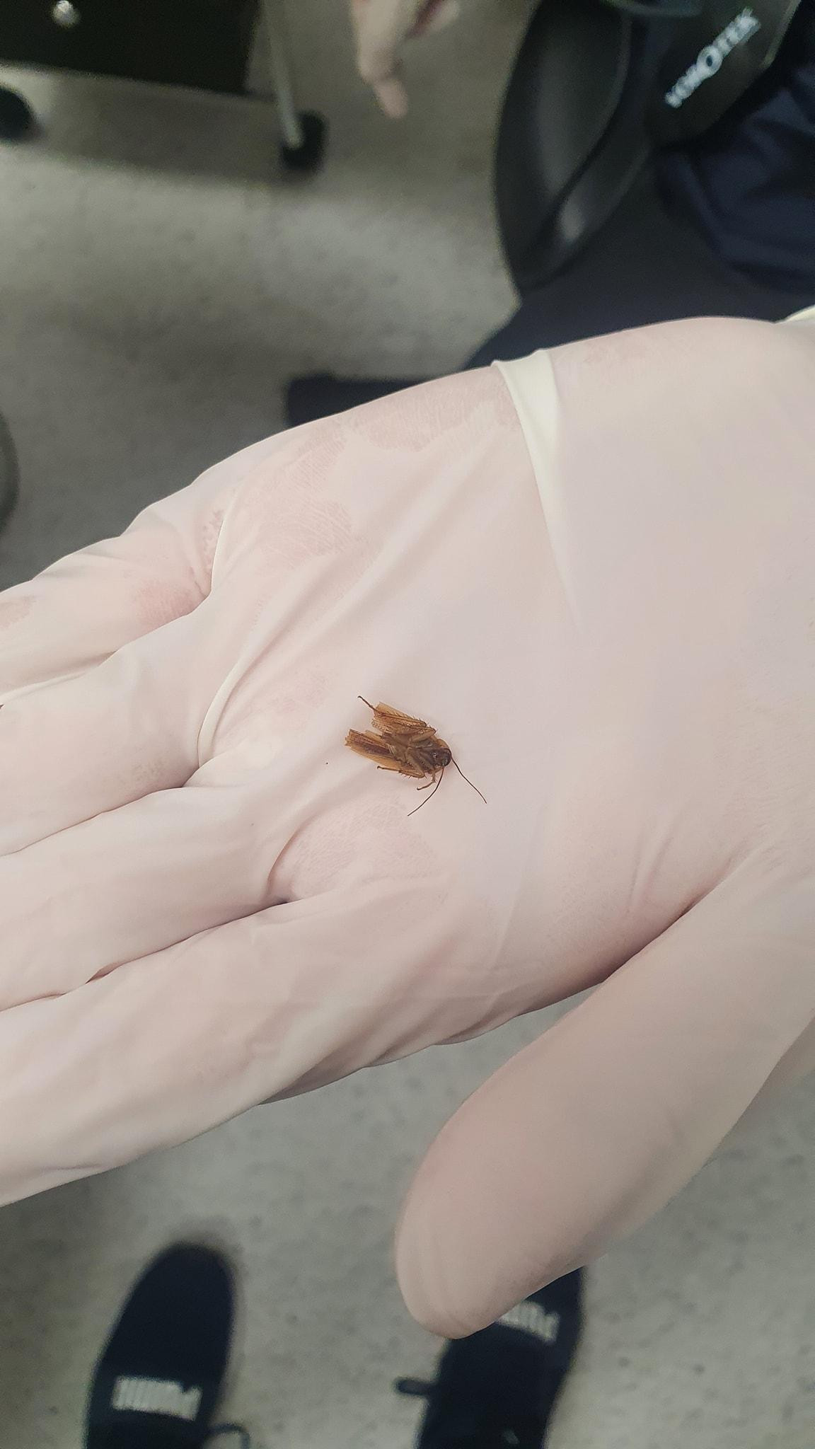 Con gián mắc kẹt trong tai Zane. Ảnh: Facebook