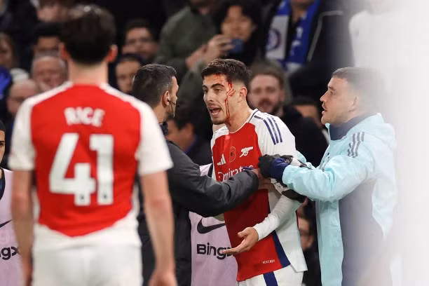 Chelsea và Arsenal chia điểm tại Stamford Bridge ảnh 24