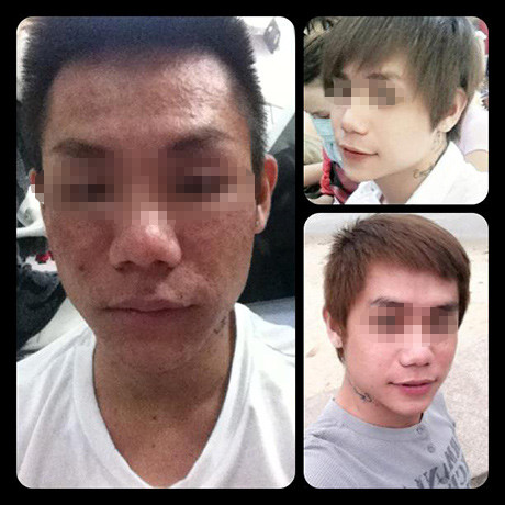 Bức ảnh anh chàng bảnh trai A.S trước, trong và sau khi trải qua 