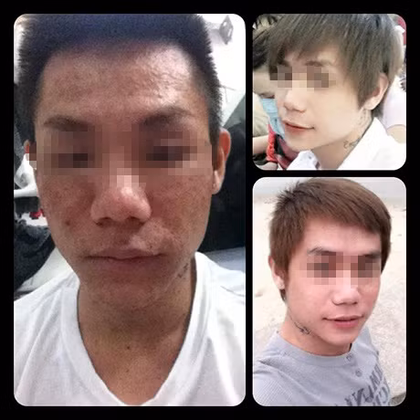 Bức ảnh anh chàng bảnh trai A.S trước, trong và sau khi trải qua 