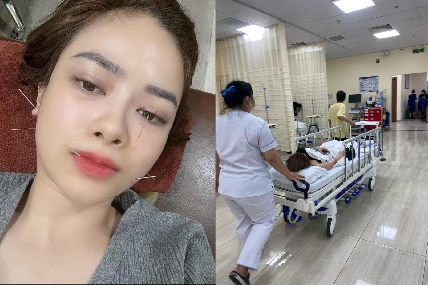 Nữ ca sĩ chia sẻ hình ảnh châm cứu và nhập viện để chữa trị ngay khi nhận thấy dấu hiệu bất thường. Nguồn: Dương Hoàng Yến (Facebook) Nữ ca sĩ chia sẻ hình ảnh châm cứu và nhập viện để chữa trị ngay khi nhận thấy dấu hiệu bất thường. Nguồn: Dương Hoàng Yến (Facebook)